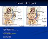 Rheumatoid Arthritis PowerPoint Presentation