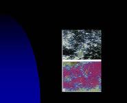 Gout and Pseudogout PowerPoint Presentation