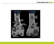 Referral and Assessment For Suspected Soft Tissue and Bone Sarcomas PowerPoint Presentation Notes