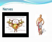 Oh My Aching Back PowerPoint Presentation