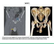 Orthopedic Emergencies PowerPoint Presentation Notes