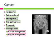 Secondaries in Bone PowerPoint Presentation Notes
