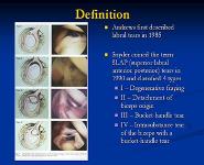 Slap Tears PowerPoint Presentation