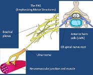 Peripheral Nerve Disorders PowerPoint Presentation Notes