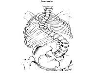 Scoliosis PowerPoint Presentation Notes