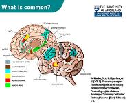 Tinnitus and Attention PowerPoint Presentation