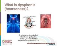 Hoarseness Dysphonia PowerPoint Presentation Notes