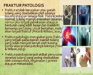 Hip Replacement PowerPoint Presentation