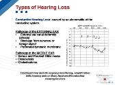 The Impact of Hearing Loss