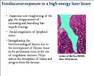 Chronic Diseases of The Pharynx PowerPoint Presentation Notes