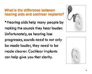 The Cochlear Implant PowerPoint Presentation