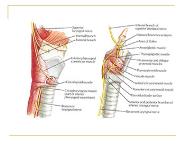 Laryngeal Paralysis PowerPoint Presentation Notes