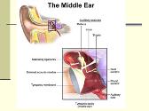 Middle Ear Disorders