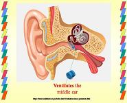 Presentations of Middle Ear Disease PowerPoint Presentation
