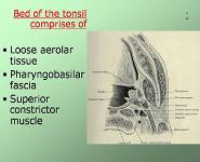 Tonsils PowerPoint Presentation