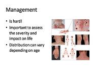 Atopic Eczema in Children PowerPoint Presentation Notes