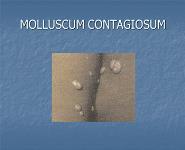 Common Childhood Infections and Rashes PowerPoint Presentation Notes