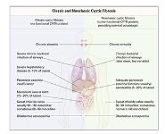 Cystic Fibrosis PowerPoint Presentation