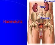 Emergency in Urology PowerPoint Presentation Notes