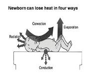 Essential Newborn Care PowerPoint Presentation