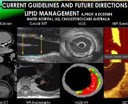 Lipid Management Medical Notes