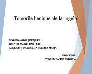 Benign Tumors of Larynx PowerPoint Presentation