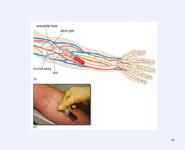 Teknik Pengambilan Bahan Pemeriksaan PowerPoint Presentation