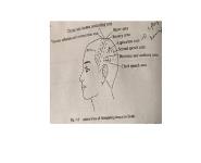Scalp Acupuncture PowerPoint Presentation
