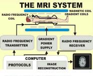 Magnetic Resonance Imaging PowerPoint Presentation