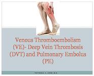 Venous Thromboembolism-Deep Vein Thrombosis-Pulmonary Embolus PowerPoint Presentation