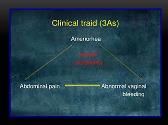 Ectopic Pregnancy
