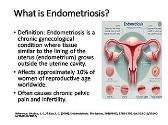 Understanding Endometriosis: Causes, Symptoms, and Treatments