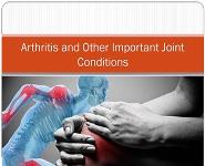 Arthritis and Other Important Joint Conditions PowerPoint Presentation