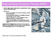 Types of Radiation Therapy