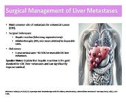Surgical Management of Metastases PowerPoint Presentation Notes