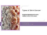Types of Skin Cancer