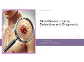Skin Cancer - Early Detection and Diagnosis