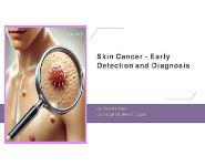 Skin Cancer - Early Detection and Diagnosis PowerPoint Presentation Notes