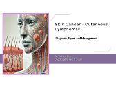 Skin Cancer - Cutaneous Lymphomas
