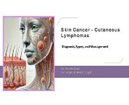 Skin Cancer - Cutaneous Lymphomas PowerPoint Presentation Notes