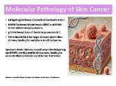Skin Cancer - Genetics and Molecular Pathology
