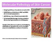 Skin Cancer - Genetics and Molecular Pathology PowerPoint Presentation Notes