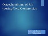 Osteochondroma of Rib Causing Cord Compression