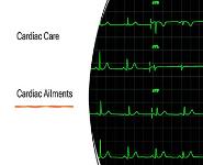 Cardiac Care Cardiac Ailments PowerPoint Presentation