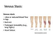 Venous Thrombosis PowerPoint Presentation