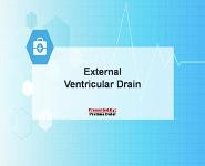 External Ventricular Drain PowerPoint Presentation Notes