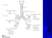 Acute Respiratory Distress Syndrome (ARDS)
