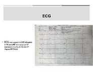 Delirium PowerPoint Presentation Notes