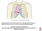 Cardiology grammar (Concepts) - Congenital heart disease