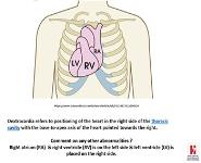 Cardiology grammar (Concepts) - Congenital heart disease PowerPoint Presentation